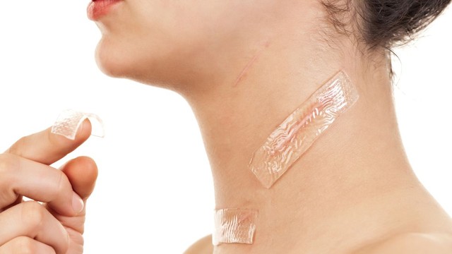 bai-viet/bi-seo-kieng-an-gi-loi-khuyen-dinh-duong-cho-tung-loai-seo.html