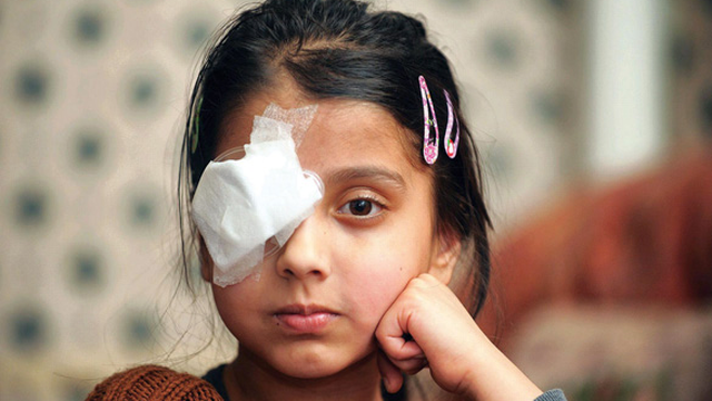 bai-viet/bi-vat-nhon-choc-vao-mat-thi-xu-ly-nhu-the-nao.html