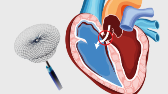 bai-viet/bien-chung-sau-mo-thong-lien-nhi-ma-ban-co-the-gap-phai.html