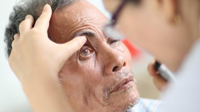 bai-viet/bien-chung-tieu-duong-o-mat-bieu-hien-va-cach-khac-phuc.html