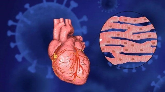 bai-viet/bien-chung-va-dieu-tri-viem-co-tim-ban-nen-biet.html