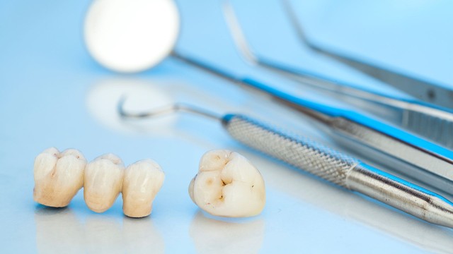 bai-viet/boc-rang-ham-bi-sau-gia-bao-nhieu-quy-trinh-thuc-hien.html