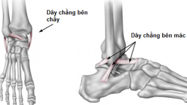 bai-viet/bong-gan-man-tinh-la-gi-bieu-hien-co-anh-huong-nghiem-trong-khong-52312.html