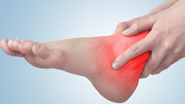 bai-viet/bong-gan-mat-ca-chan-la-gi-dau-hieu-nhan-biet-can-lam-gi-de-nhanh-khoi-52230.html