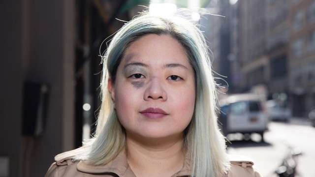 bai-viet/bot-ota-la-gi-dac-diem-lam-sang-phuong-phap-chan-doan-va-dieu-tri-bot-ota.html