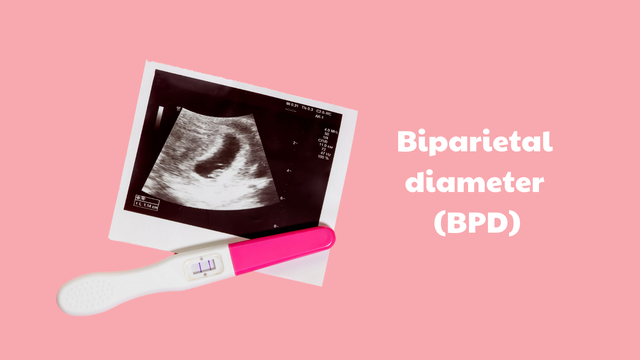 bai-viet/bpd-trong-sieu-am-thai-la-gi-khi-nao-thuc-hien-do-chi-so-bpd.html