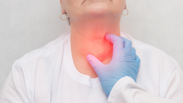 Bướu cổ (Bướu giáp): Dạng rối loạn tuyến giáp phổ biến