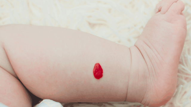 bai-viet/tat-ca-nhung-thong-tin-ban-can-biet-ve-buou-mau-duoi-da.html