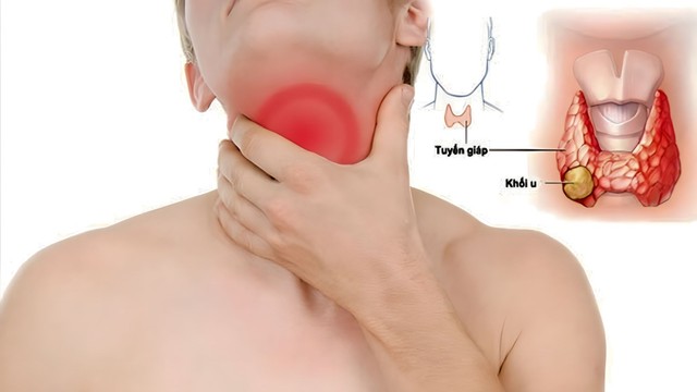 bai-viet/c73-u-ac-tuyen-giap-la-gi-va-c73-lien-quan-den-nhung-benh-ly-nao.html