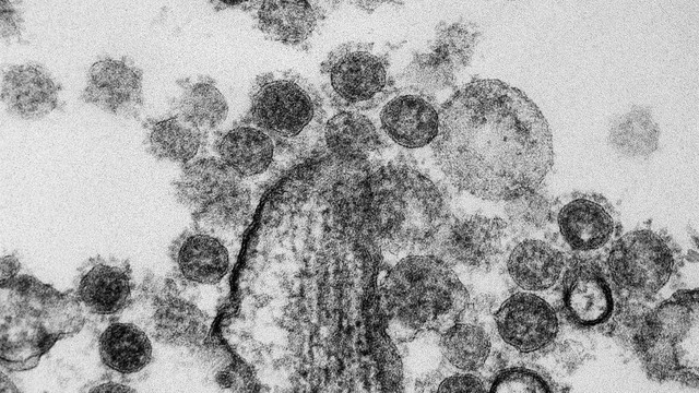 bai-viet/cac-benh-thuong-gap-trong-va-sau-mua-mua-lu.html