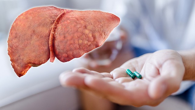 bai-viet/cac-bien-phap-dieu-tri-xo-gan-ma-ban-nen-biet.html