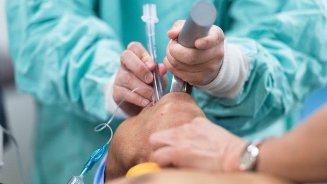 bai-viet/cac-buoc-tien-hanh-noi-soi-phe-quan-duoi-gay-me.html