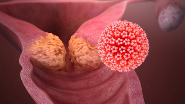 bai-viet/cac-dau-hieu-ung-thu-am-ho-thuong-gap-va-cach-phong-ngua-benh-chi-em-nen-biet.html