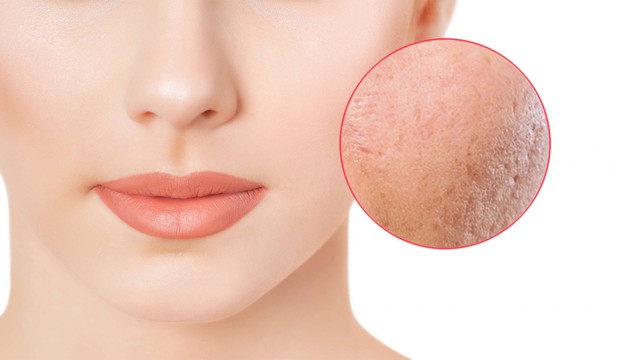 bai-viet/cac-lieu-trinh-tai-tao-da-mat.html