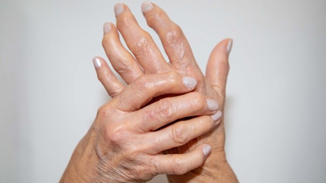 bai-viet/cac-loai-viem-khop-dang-thap-thuong-gap.html