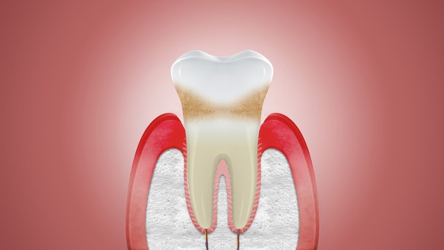 bai-viet/cac-ly-do-khien-nuou-bi-ton-thuong-va-cach-khac-phuc.html