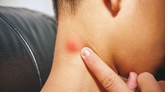 bai-viet/cac-nhom-hach-dau-mat-co.html