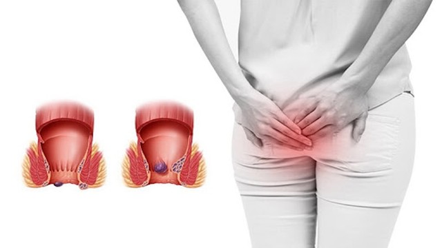 bai-viet/cac-phuong-phap-dieu-tri-benh-tri-moi-nhat-hien-nay.html