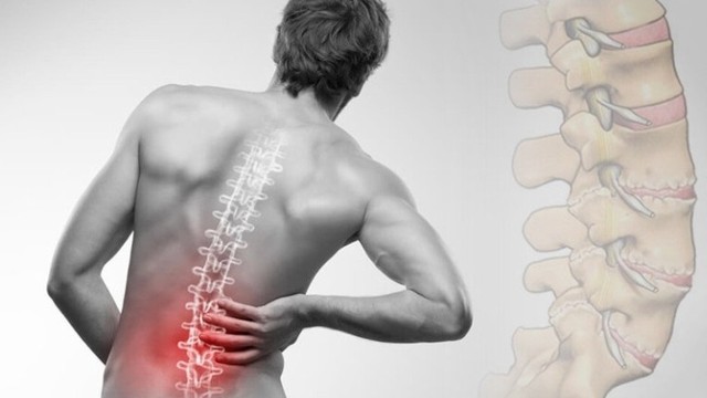 bai-viet/cac-phuong-phap-dieu-tri-gai-cot-song-ban-co-the-chua-biet.html