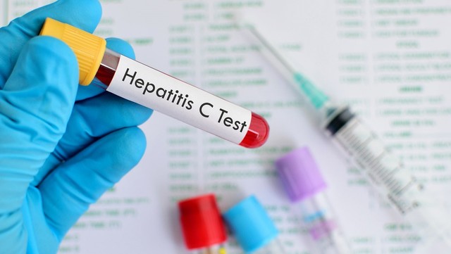 bai-viet/cac-phuong-phap-va-thoi-gian-dieu-tri-viem-gan-c.html