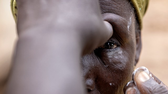 bai-viet/cac-trieu-chung-dau-mat-hot-ma-ban-nen-biet.html