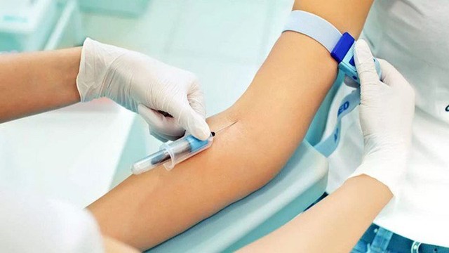 bai-viet/cac-xet-nghiem-gan-u-mat-ban-can-biet.html