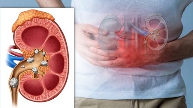 bai-viet/cach-nhan-biet-diem-dau-nieu-quan.html