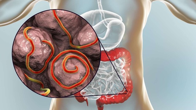 bai-viet/huong-dan-cach-bat-giun-kim-o-bo-phan-sinh-duc-nu.html