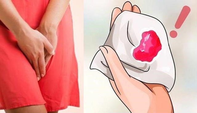 bai-viet/cach-cam-mau-khi-bi-bang-huyet-va-bien-phap-dieu-tri-bang-huyet-sau-sinh.html