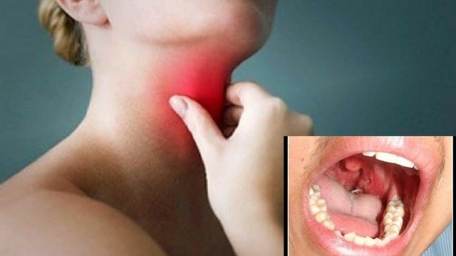 bai-viet/cach-so-cap-cuu-khi-bi-hoc-di-vat-tai-nha-59944.html