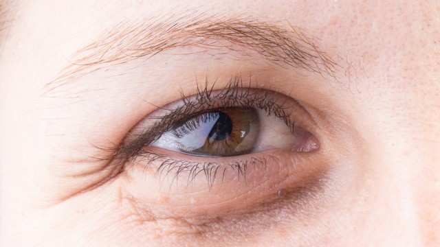 bai-viet/cach-chon-serum-tri-tham-mat-hieu-qua-nhat-hien-nay-65848.html