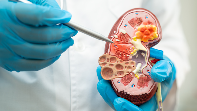 bai-viet/mot-so-cach-chua-soi-than-don-gian-tai-nha-ma-ban-co-the-tham-khao.html