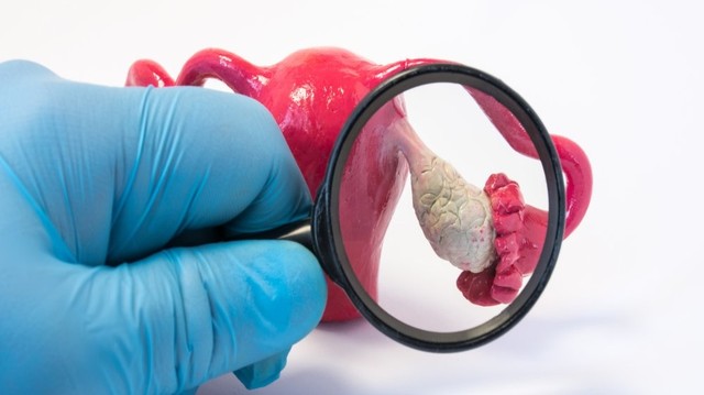 bai-viet/cach-dieu-tri-u-nang-buong-trung-nhung-phuong-phap-hieu-qua-va-luu-y.html