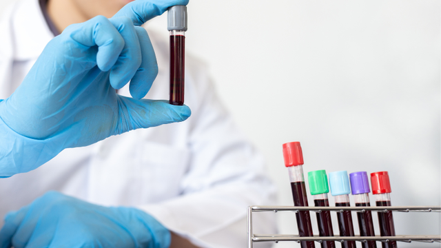 bai-viet/cach-doc-ket-qua-xet-nghiem-nipt-dung-cach-me-bau-can-biet.html