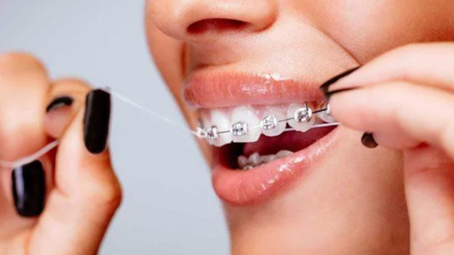 bai-viet/cach-dung-chi-nha-khoa-cho-nguoi-nieng-rang-1.html