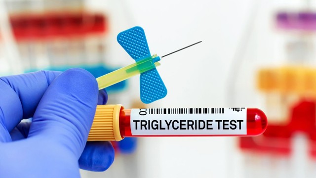 bai-viet/cach-giam-triglyceride-duoc-chuyen-gia-khuyen-nghi-dung-bo-lo.html