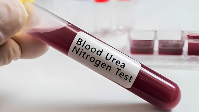 bai-viet/cach-giam-ure-trong-mau-hieu-qua-bao-ve-suc-khoe-nguoi-benh.html