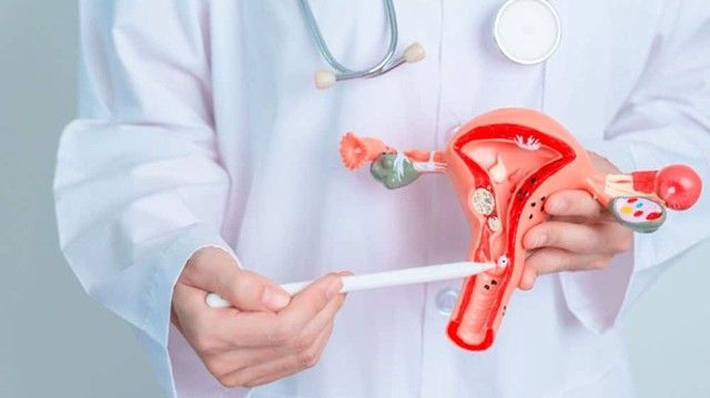 bai-viet/cach-khac-phuc-niem-mac-tu-cung-day-giai-phap-hieu-qua-cho-phu-nu.html