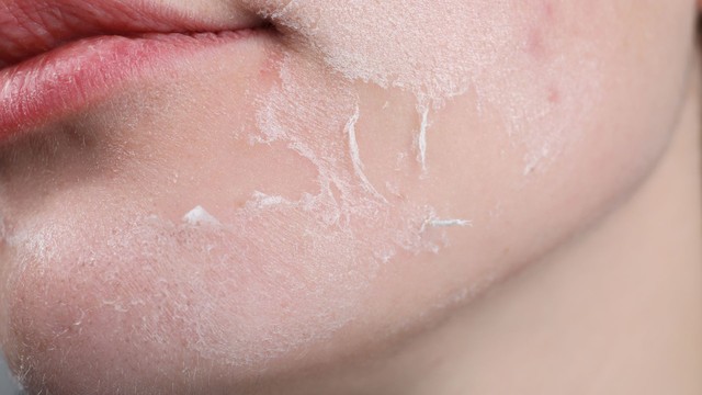 bai-viet/cach-lam-bong-da-mat-nhanh-nhat-khi-tai-tao-ma-ban-co-the-tham-khao.html