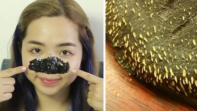 bai-viet/cach-lam-gel-lot-mun-than-hoat-tinh-ngay-tai-nha.html