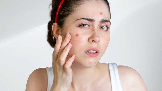 bai-viet/cach-lam-mun-boc-nhanh-chin-don-gian-hieu-qua-va-lanh-tinh-71774.html