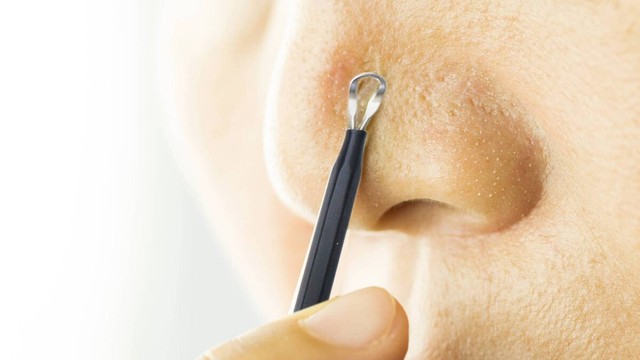 bai-viet/cach-nan-mun-bang-cay-nan-mun-ma-ban-nen-biet.html