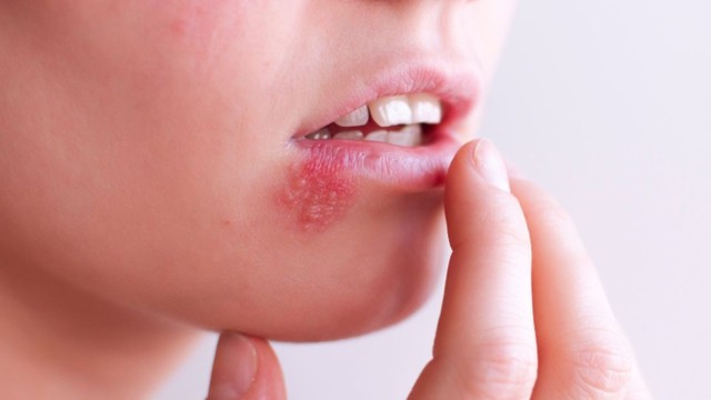 bai-viet/cach-nhan-biet-benh-gioi-leo-va-kien-ba-khoang-can.html