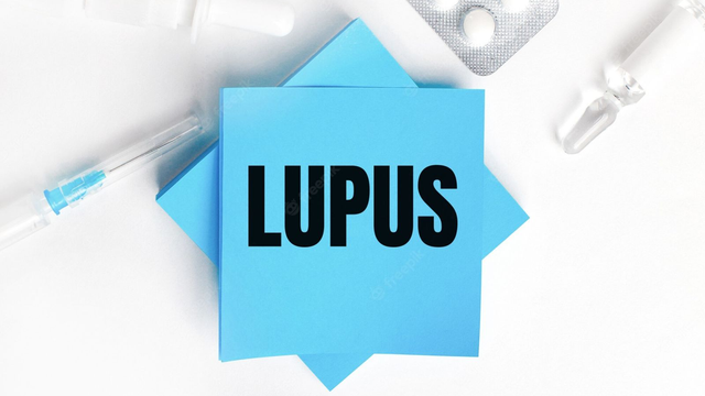 bai-viet/cach-nhan-biet-bieu-hien-cua-lupus-ban-do-he-thong-56613.html