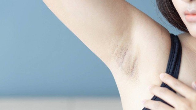 bai-viet/cach-nho-long-nach-khong-can-nhip-don-gian-tai-nha-64550.html