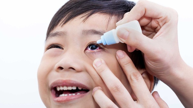 bai-viet/cach-phong-benh-dau-mat-do-o-tre-em-bo-me-can-biet.html