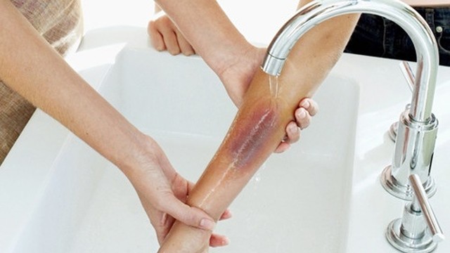 bai-viet/cach-tri-bong-bo-xe-may-cho-tre-em-don-gian-nhanh-lanh.html