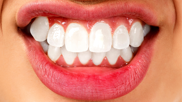 bai-viet/cach-tri-nghien-rang-khi-ngu-va-nhung-thong-tin-ban-can-biet.html