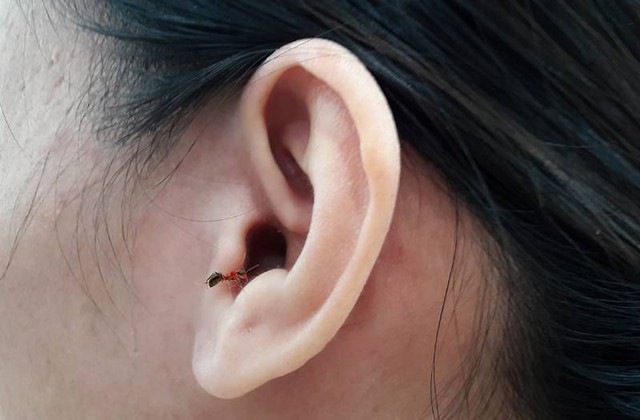 bai-viet/cach-xu-ly-kien-chui-vao-tai-an-toan-va-hieu-qua-46500.html