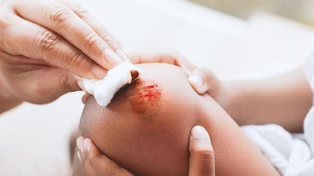 bai-viet/cach-xu-ly-vet-thuong-phan-mem-va-mot-so-luu-y-de-vet-thuong-phan-mem-mau-lanh.html